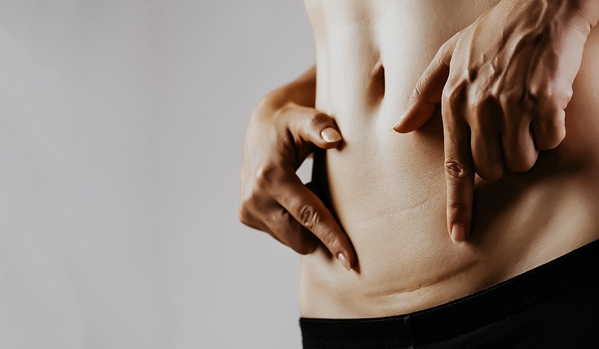 Frequently Asked Questions: Scar Healing with Nurse Melisa