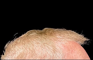 Hair Before & After