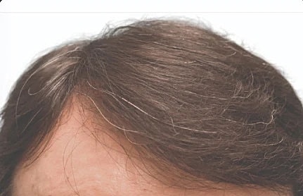 Hair Before & After