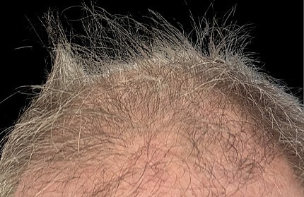 Hair Before & After