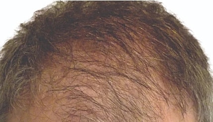 Hair Before & After