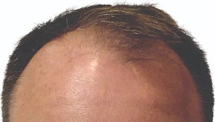 Hair Before & After