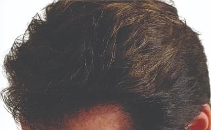 Hair Before & After