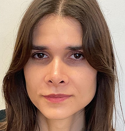Rhinoplasty Before & After