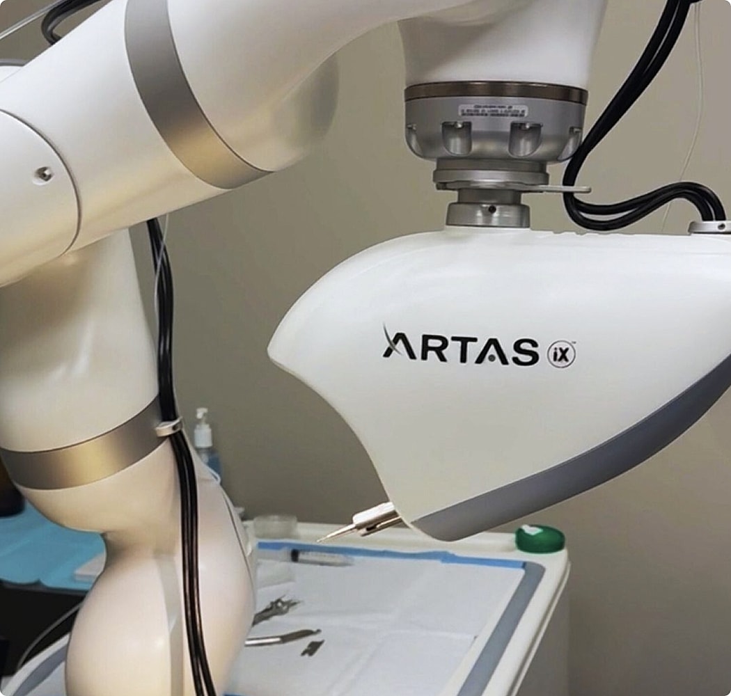 Surgical robot assisting in hair restoration procedure.