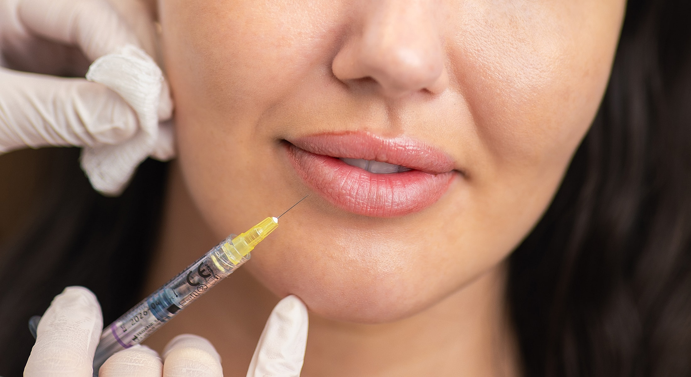Toronto dermal filler model with syringe and gloves.